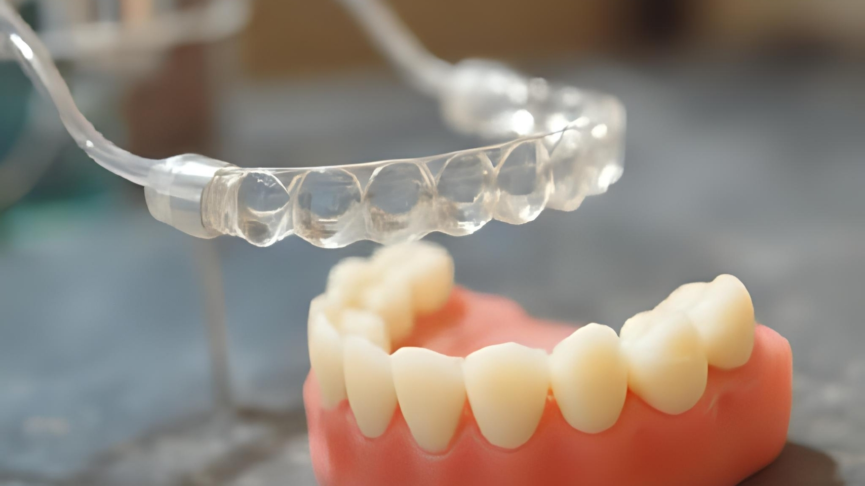 Invisalign® Clear Aligner Treatment in Johannesburg 