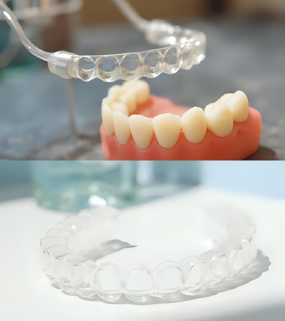 Invisalign® Clear Aligner Treatment in Cape Town 
